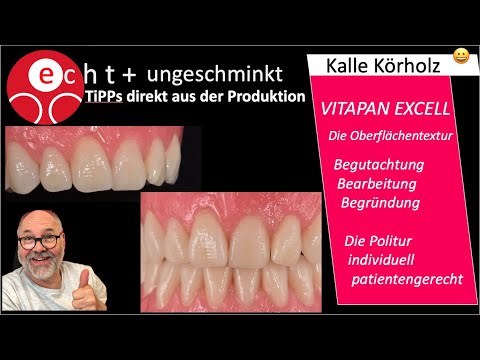 VITAPAN EXCELL Die individuelle Bearbeitung der Oberfläche