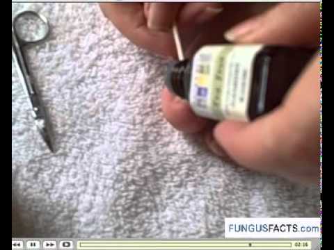 Nail treatment sa Lipetsk Folk remedyo para sa mga halamang-singaw