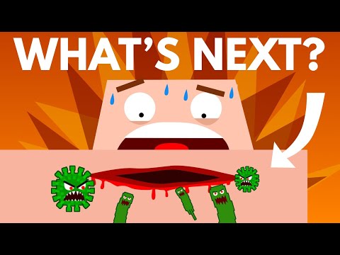 How Your Body Fights an Infection