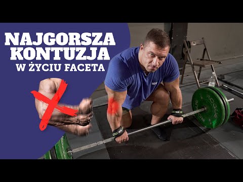 KONTUZJA BIG MAJKA - BÓL W STAWIE ŁOKCIOWYM