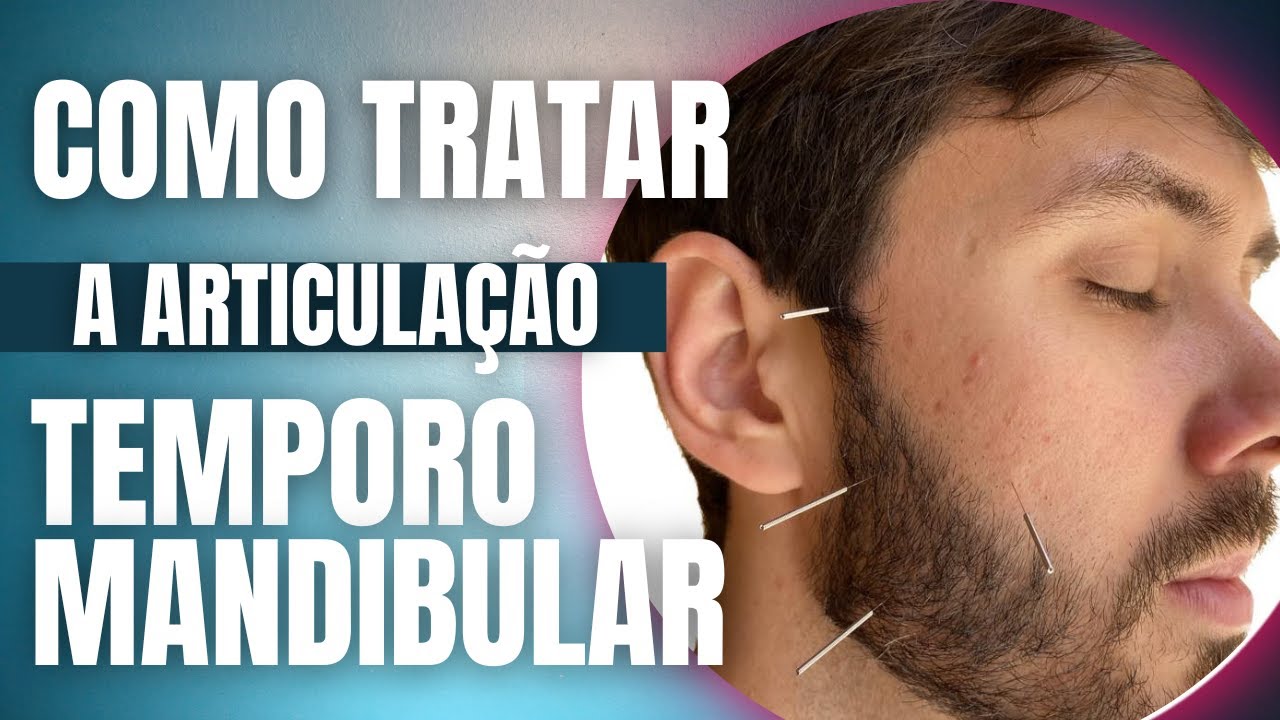 ACUPUNTURA PARA ATM - Dica de Pontos