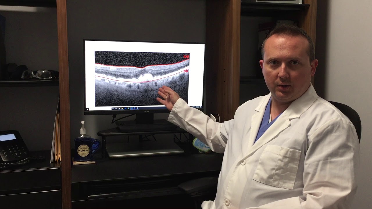 Dr. Josh discusses Age-Related Macular Degeneration