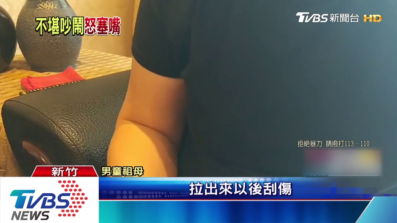 嘴破!男童吵鬧 幼園老師「塞異物」要他安靜
