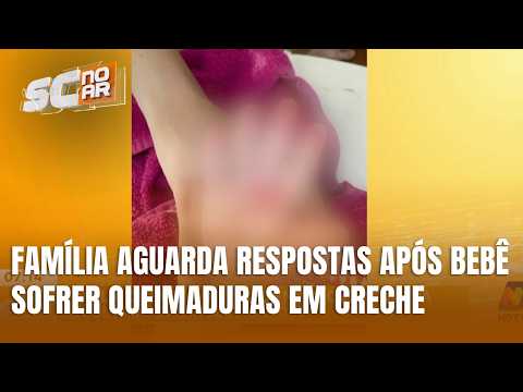 Família busca responsabilização após bebê se ferir em creche municipal