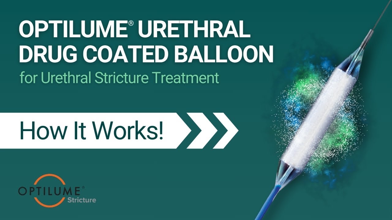 Optilume® Urethral Drug Coated Balloon for Urethral Stricture Treatment - Animation, How It Works.