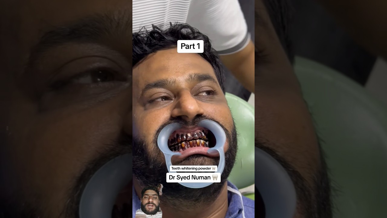 Very nice dentist doctor treatment #funny #comedy #duet #unfrez #love #biglaughs #besties #ventriloq