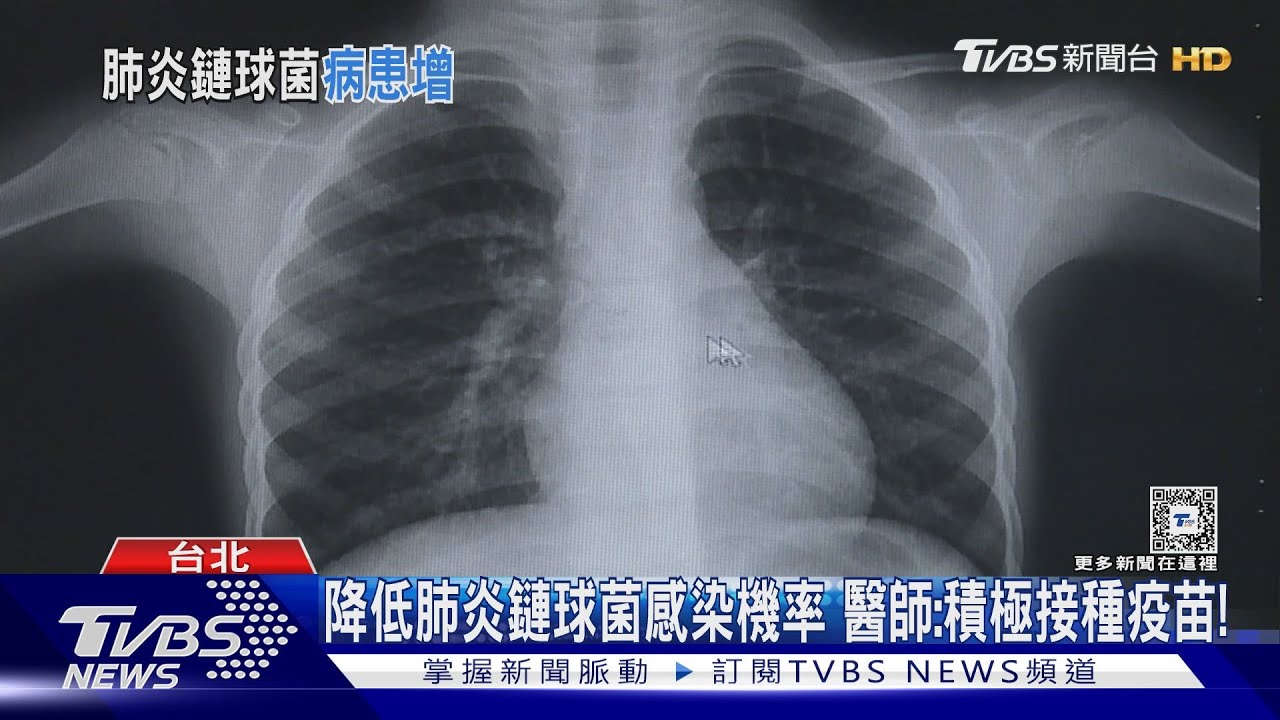 小心!「這菌種」透過「飛沫傳播」進人體 醫師:有致死風險