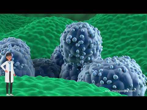 Die Symptome von Prostatakrebs