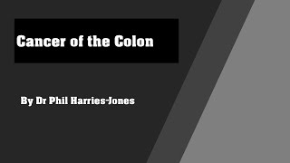 Cancer of the Colon by Dr Phil Harries-Jones