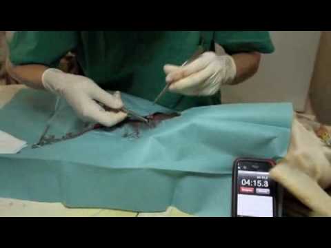 Prostate Ultraschallblasen Samenblase Symptome der Krankheit Prostatitis