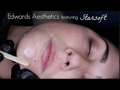 Edwards Aesthetics | Face Wax-Leg Wax | featuring Starsoft