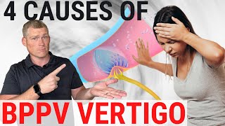 What Causes BPPV? Top 4 causes (Benign Paroxysmal Positional Vertigo)