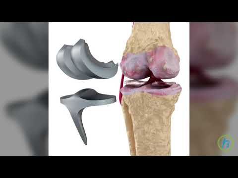 Tratament articular și al coloanei vertebrale