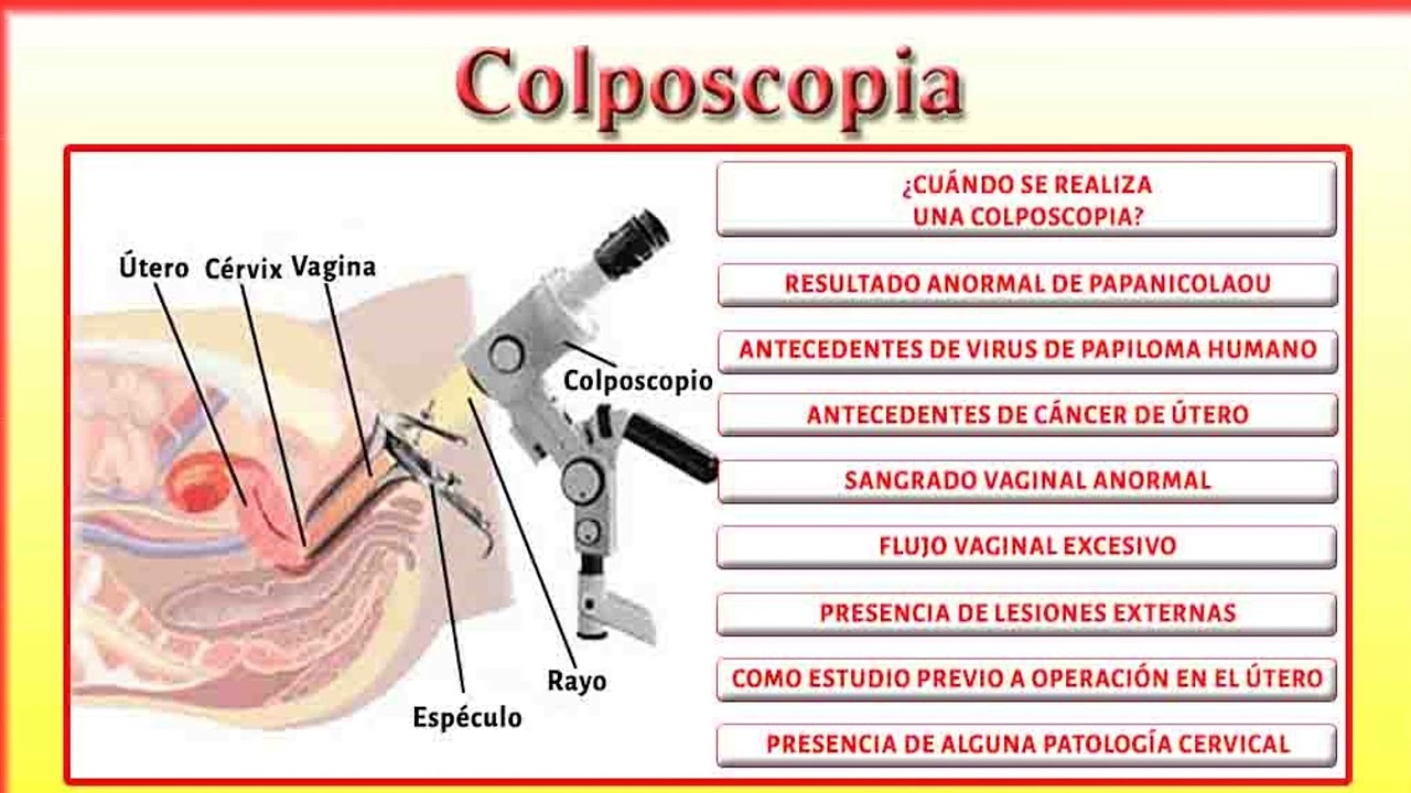 Jessica Pedraza Villanueva-20