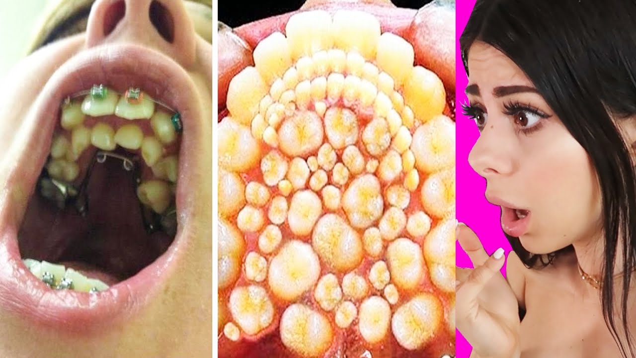 Watch video Unique BODY FEATURES That Only 5% of People Have ! Now Unique BODY FEATURES That Only 5% of People Have !