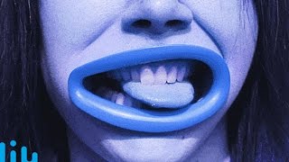 KISS THIS HYPERLIP -- LÜT #56