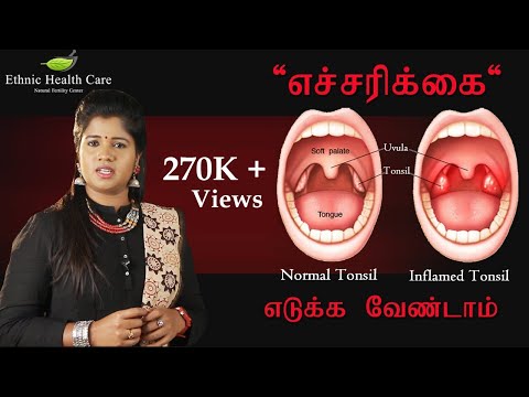 அடிநாக்கு சதையில் அழற்சி | டான்சில் நோய் | Tonsillitis - Immunity - Cure | Dr.Yoga Vidhya