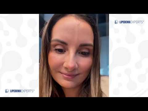 Vídeo de feedback