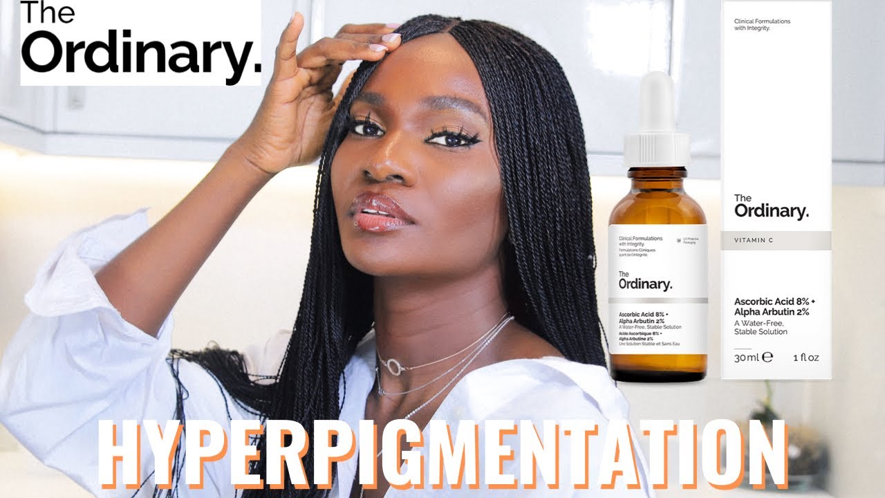 THE ORDINARY ASCORBIC ACID 8% ALPHA ARBUTIN 2% VITAMIN C SERUM REVIEW