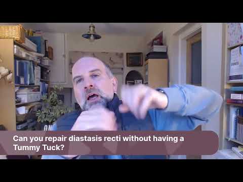 #AskJJ Can you repair diastasis recti without having a Tummy Tuck?