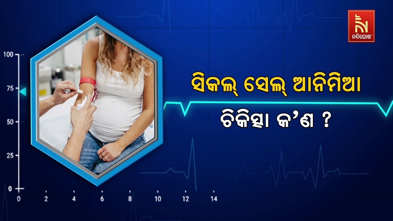 🔴 Live | ସିକଲ୍ ସେଲ୍ ଆନିମିଆ :  ଚିକିତ୍ସା କ'ଣ ?