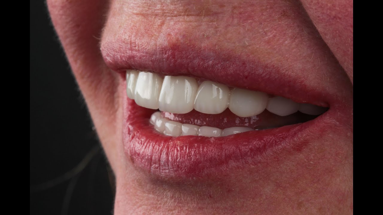 Lındsay C., Dentakademi Oral & Dental Healthcare Center