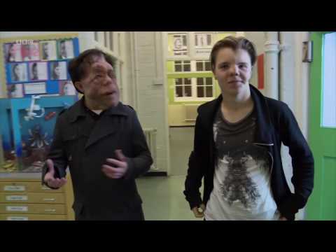 Adam Pearson and Lucas Hayward on bullying The Ugly Face of Disability Hate Crime BBC Thre