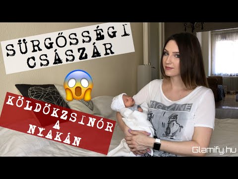 a kismedence és a császármetszés visszér