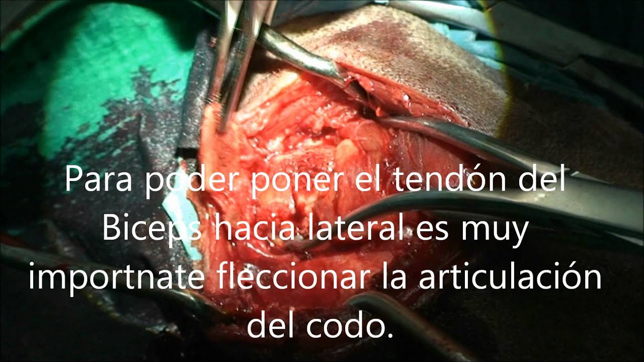 Watch LUXACIÓN DE HOMBRO PERRO Now LUXACIÓN DE HOMBRO PERRO