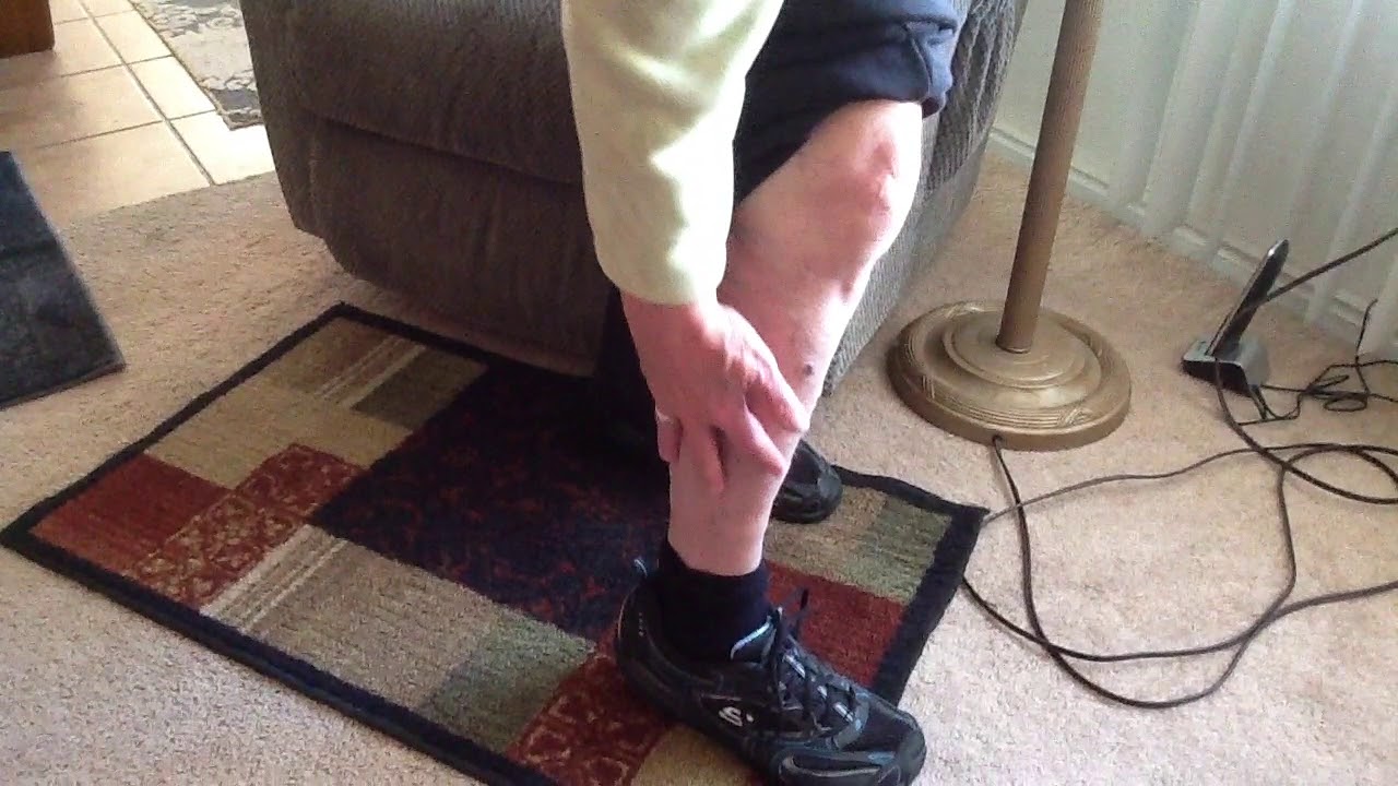 LifetimeVibeVaricose Veins LifetimeVibe