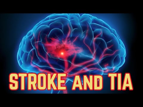 Stroke and TIA (updated 2023) - CRASH! Medical Review Series