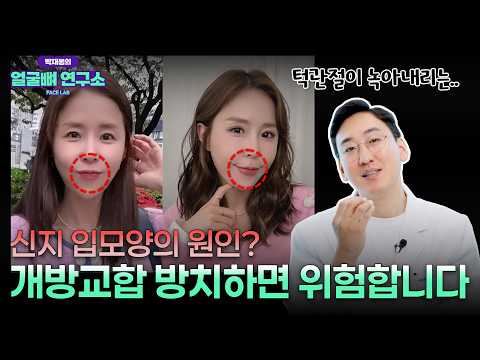 신지 입모양이 어색해진 이유? 방치하면 큰일나는 이 '질환' 꼭 확인하세요｜개방교합