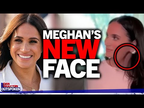 "Plastic surgery" Meghan Markle's new face exposed as Prince Harry admits "can't stand her" in gaffe