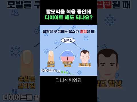 다이어트 중인데 탈모약 복용은 가능할까요?