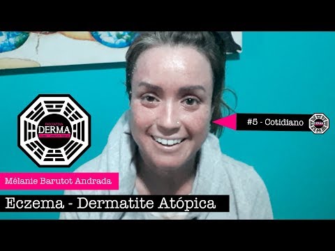 Leczema di fotografia cominciante Unguento momat ed eczema