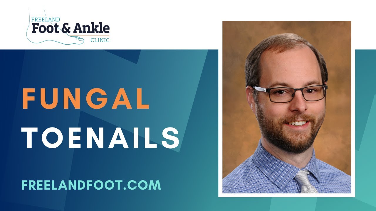 Fungal Toenails | Freeland Foot & Ankle Clinic