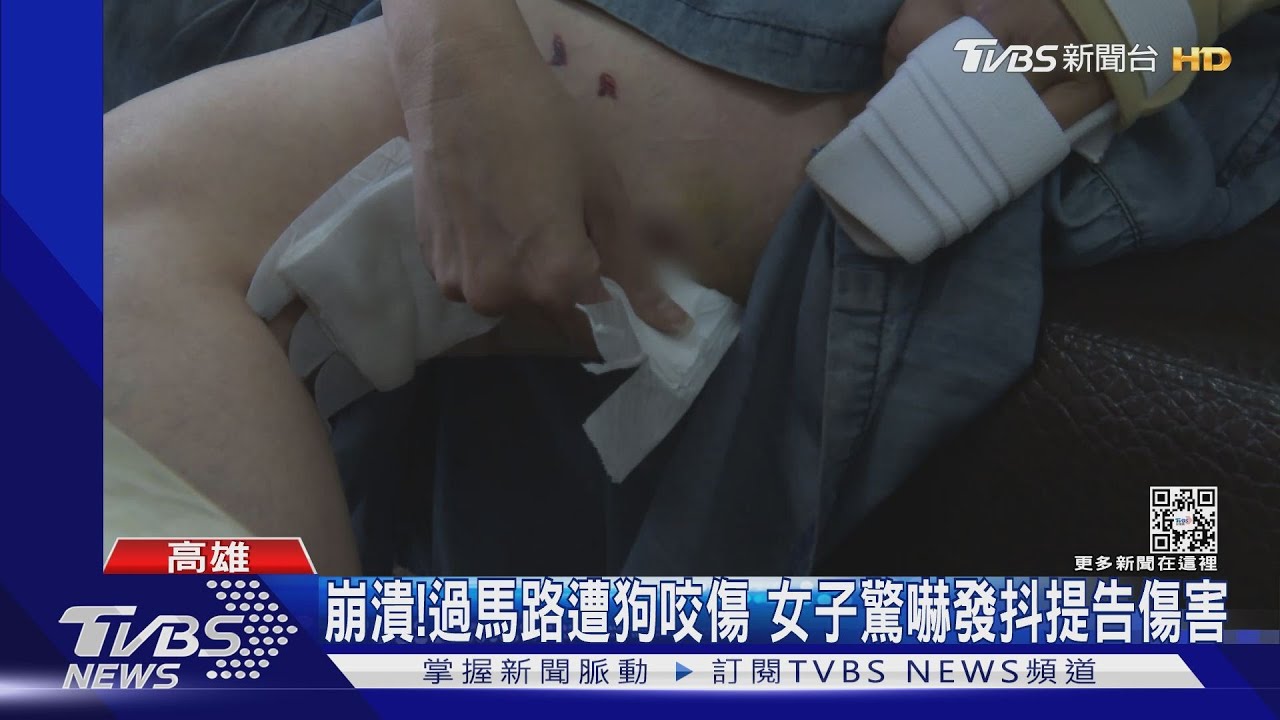 嚇到發抖！女遭狗咬傷崩潰提告　這邊也有騎士棄車躲狗追