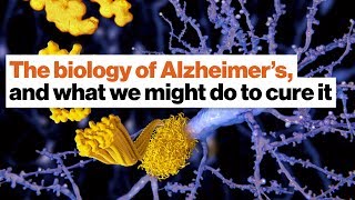 The biology of Alzheimer’s – and what we might do to cure it |  Lou Reese