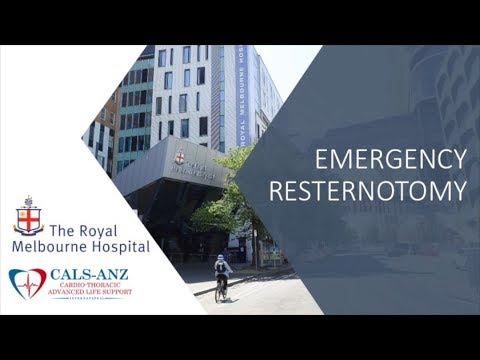 CALS Resternotomy VF Arrest