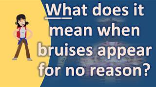 What does it mean when bruises appear for no reason ? |Frequently ask Questions on Health