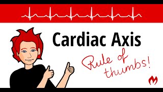 ECG / EKG Cardiac Axis - Rule of Thumbs