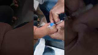 Cannulation.. videos.. part 1047 #shorts #viral