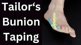 Tailors Bunion Pain Relief Taping
