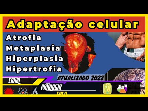 Adaptação Celular: Hipertrofia, Hiperplasia, Hipotrofia, Metaplasia (Patologia) [atualizado]