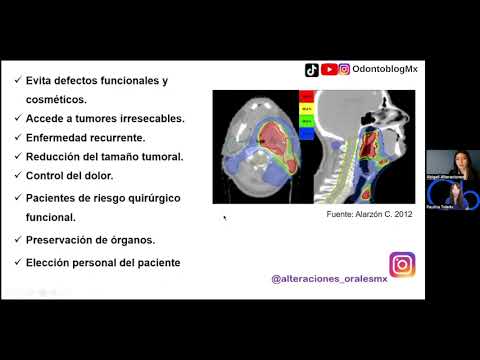 Radioterapia de cabeza y cuello