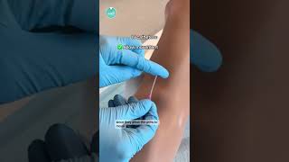 Download lagu 💉 How an IV Works! mp3