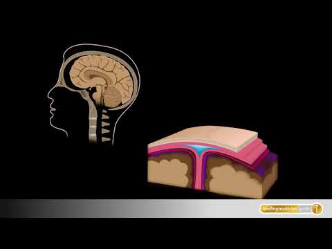 Schädel-Hirn-Trauma: Das passiert bei Erschütterungen des Gehirns