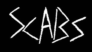 SCABS - Demo CS