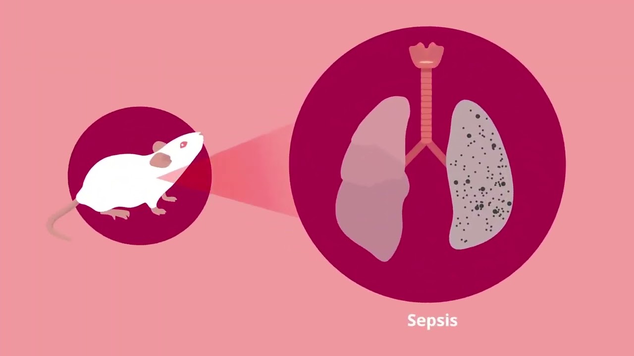 New Insights into Sepsis  S1PR2's Role in Alleviating Lung Injury