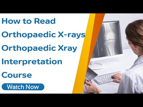 How to Read Orthopaedic X-Rays